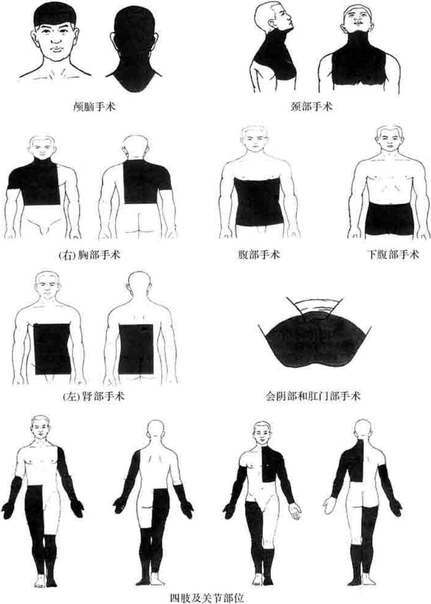 第二節(jié) 手術人員和病人手術區(qū)域的準備